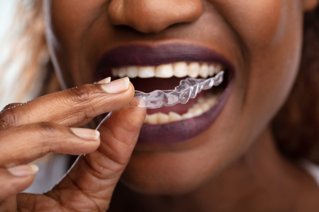 Invisalign Orthodonitst Near Me Long Beach, NY
