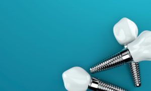replace missing teeth with dental implants